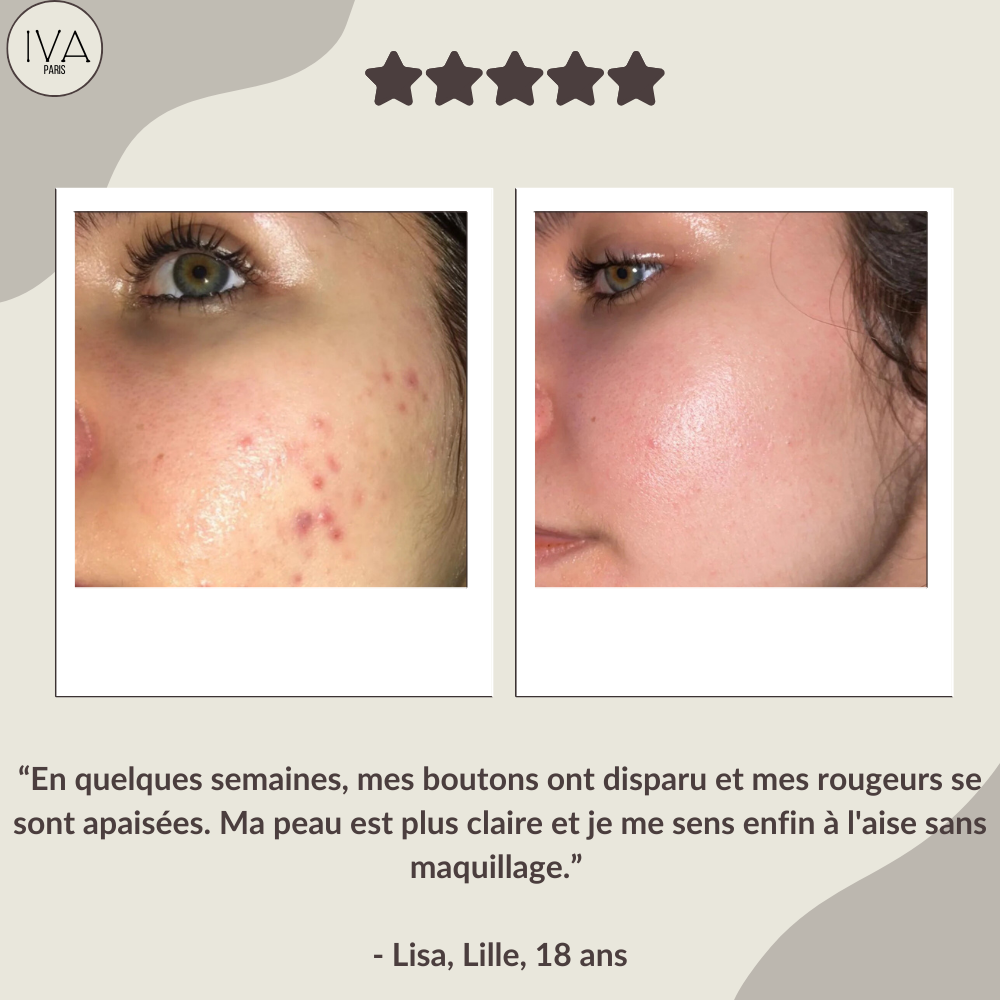 Masque LED anti-rides/anti-imperfections